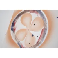 Cheap Louis Vuitton LV Hoodies Long Sleeved For Men #1395948 Replica Wholesale [$45.00 USD] [ITEM#1395948] on Replica Louis Vuitton LV Hoodies